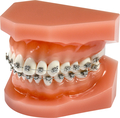 Orthodontic demonstration model discovery® smart sl