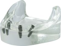 Modèle de démonstration acrylique, tioLogic® TWINFIT, mandibule, édenté, 4 implants, sans équipement prothétique
